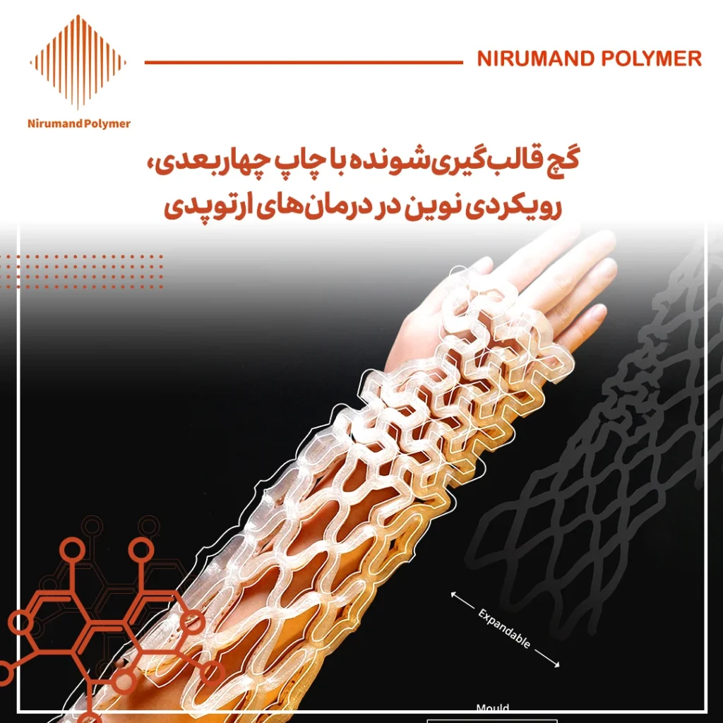 گچ قالب‌گیری‌شونده با چاپ چهار‌بعدی، رویکردی نوین در درمان‌های ارتوپدی